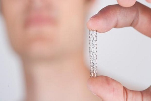 Stent vascolari