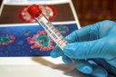 Online “Test rapidi per la ricerca qualitativa dell'antigene specifico del virus Sars-Cov-2”